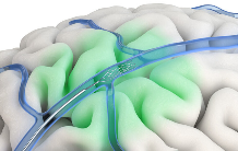 脑机接口技术突破｜陈天桥布局引领未来交互变革(图3)